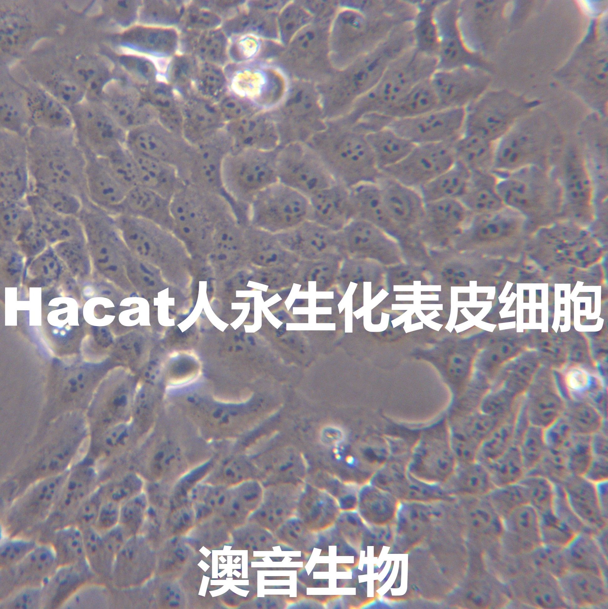 HaCaT[HaCAT; HACAT; Hacat]人永生化表皮细胞