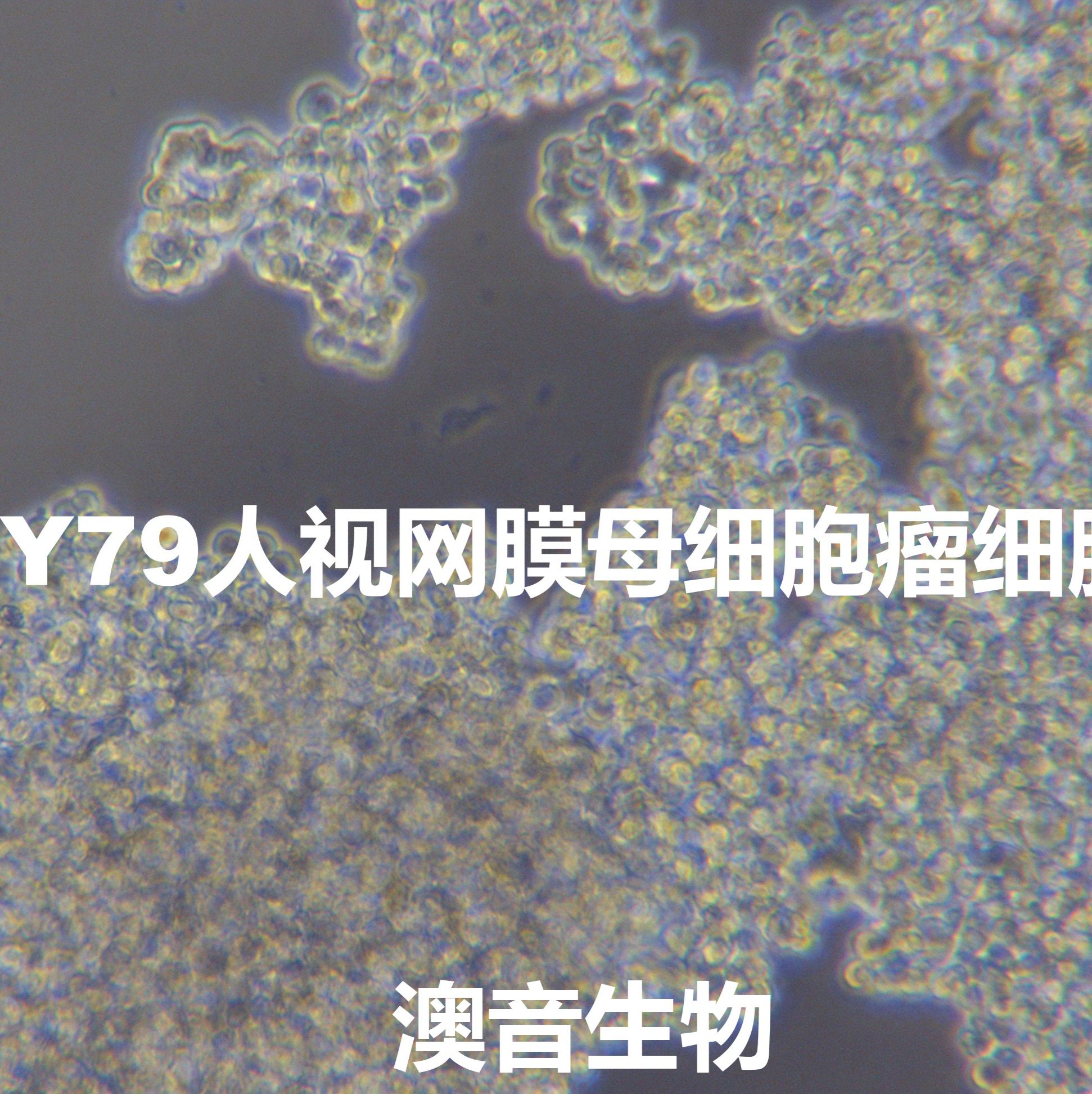 Y79[Y-79；Y79; GM01232; GM01232E]人视网膜母细胞瘤细胞