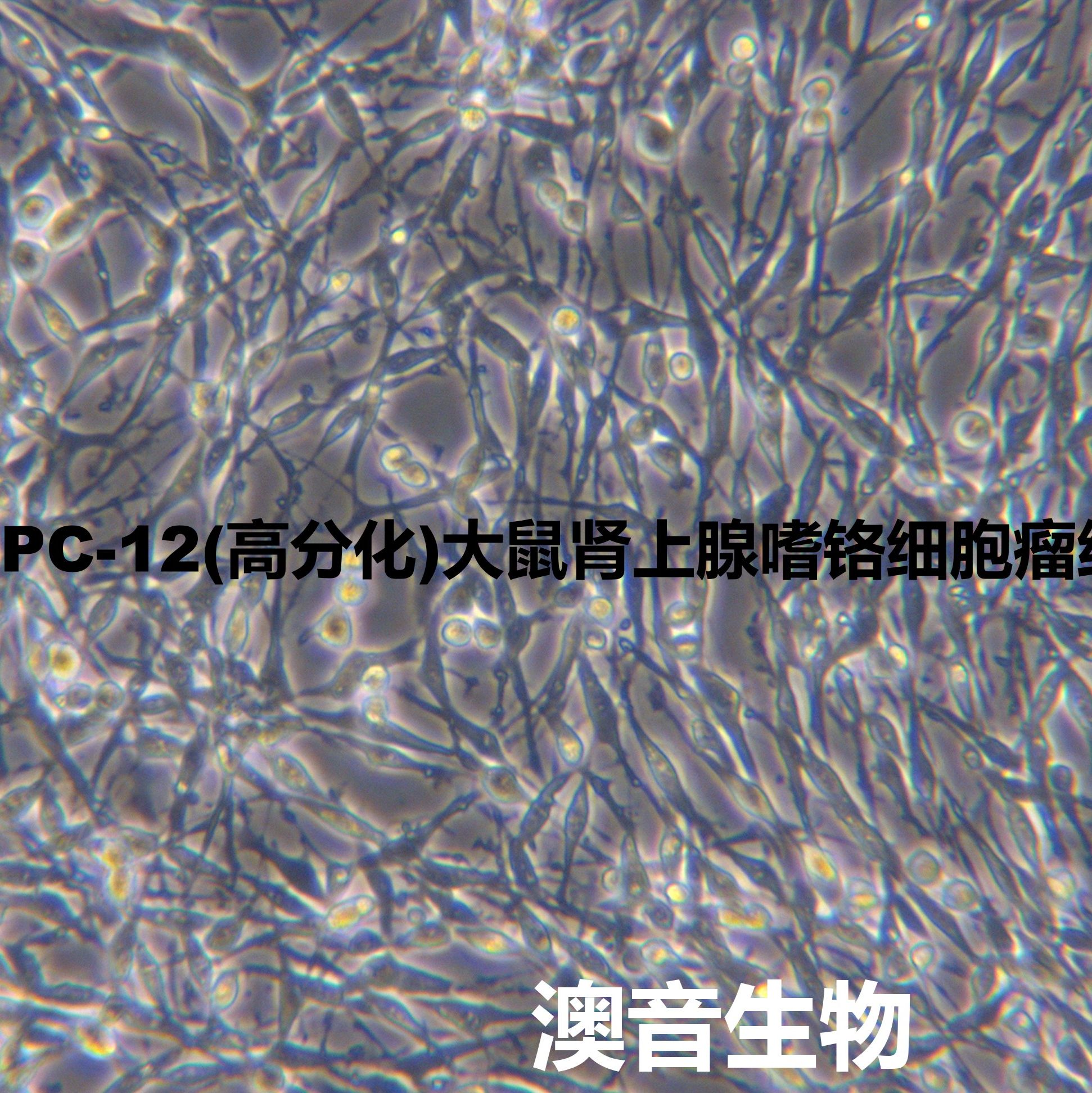 PC-12高分化【PC12高分化】|PC12细胞(高分化)大鼠肾上腺嗜铬细胞瘤细胞高分化