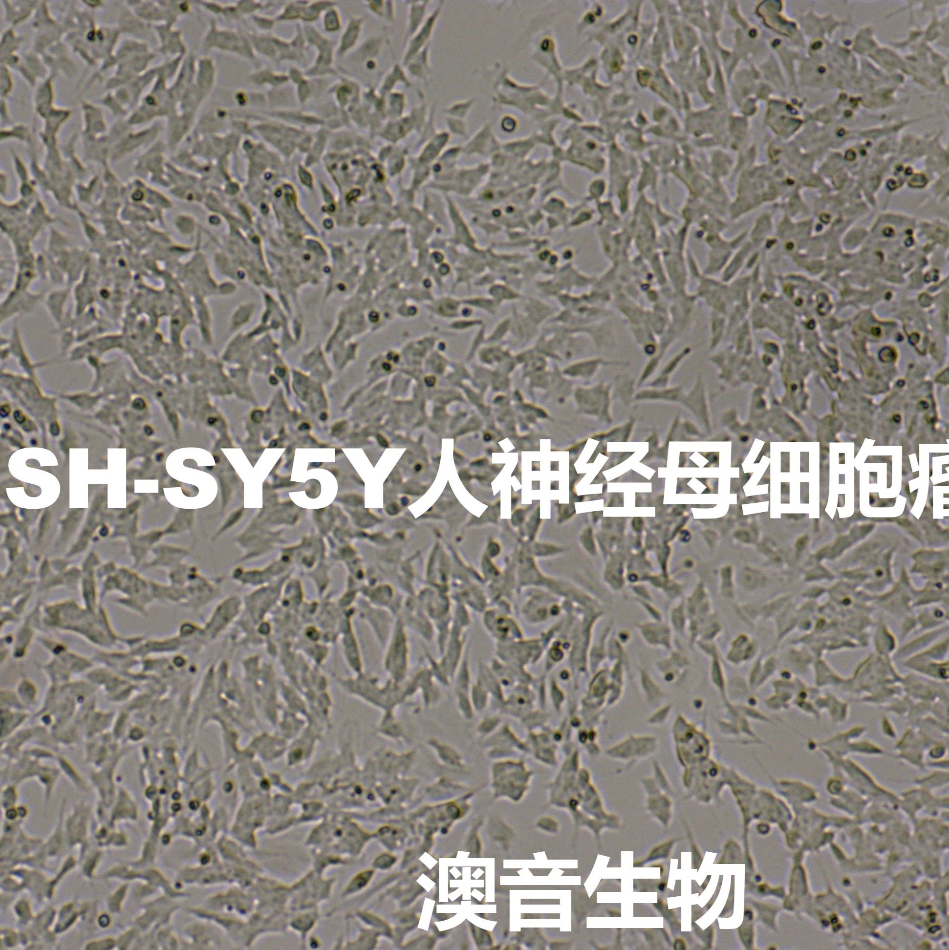 SH-SY5Y[SHSY5Y; SHSY-5Y; SH-Sy5y; SK-SH-SY5Y; SY5Y]人神经母细胞瘤细胞