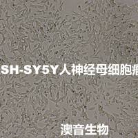 SH-SY5Y[	SHSY5Y; SHSY-5Y; SH-Sy5y; SK-SH-SY5Y; SY5Y]人神经母细胞瘤细胞