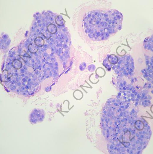 肿瘤类器官|​p53突变的胃癌类器官模型