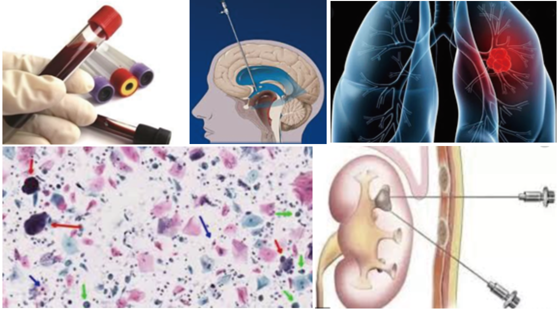 FastPrep仪器在医学检验中的应用