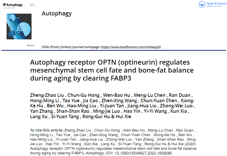 骨质疏松症的发病新机制研究