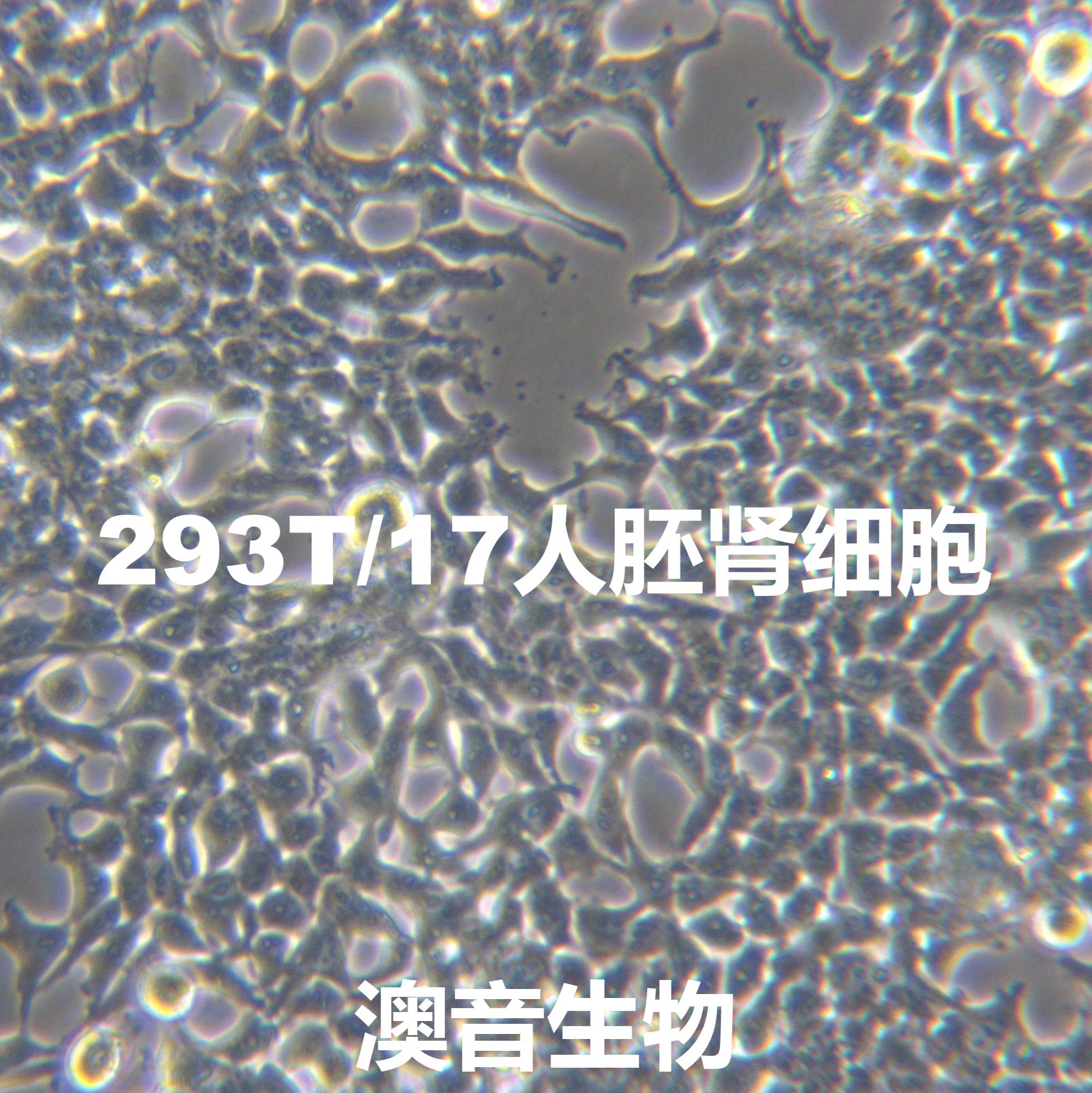 HEK293T/17[HEK 293T/17; 293T/17]SV40T转化的人胚肾细胞（亚系）