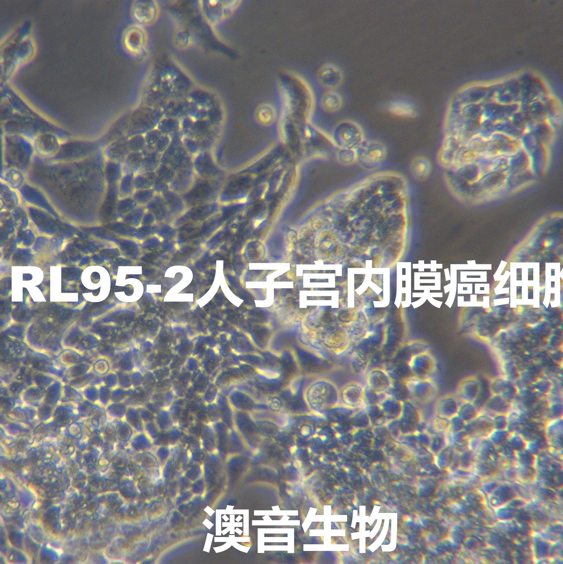 RL95-2人子宫内膜癌细胞