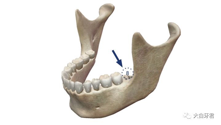 上颌第三磨牙形态图片