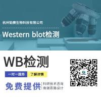 Western blot检测（WB）#Western Bloting#Western#蛋白质印迹法#免疫印迹试验