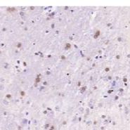 脑源神经营养因子重组兔单克隆抗体