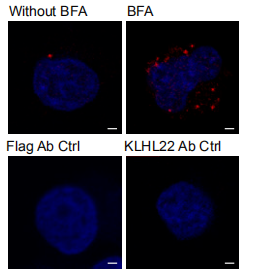 Klhl22敲除小鼠揭示调控PD-1蛋白水平稳态的新机制