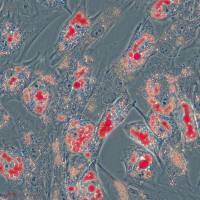 人间充质干细胞成脂诱导鉴定-技术服务