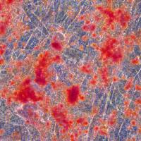 人间充质干细胞成骨诱导技术服务