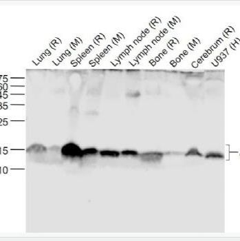 补体C3重组兔单克隆抗体
