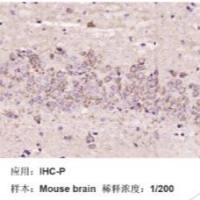 磷酸化叉头蛋白3A重组兔单克隆抗体