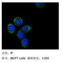 磷酸化Akt1重组兔单克隆抗体