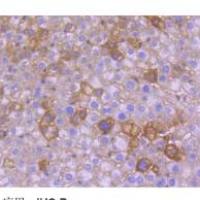 氨基末端激酶3重组兔单克隆抗体