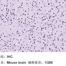 重组兔脂肪酸合成酶单克隆抗体
