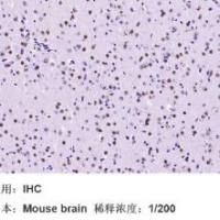 重组兔脂肪酸合成酶单克隆抗体