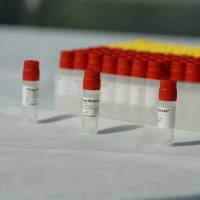 粪便匀浆液 Feces Homogenate