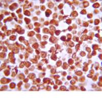 Merckmillipore 07-1479 Anti-IKKb (rabbit