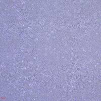 人脐带间充质干细胞