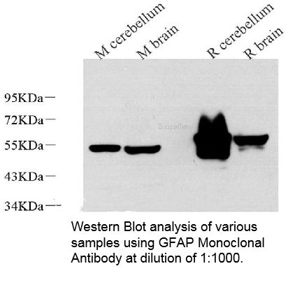 GFAP Monoclonal Antibody B-IO-10197