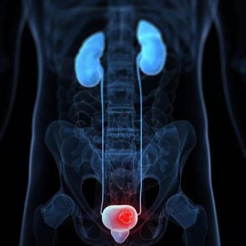 肿瘤类器官|​膀胱癌类器官模型