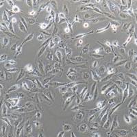 C75人Dukes'D期的中度分化的人结直肠腺癌