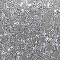 Clone M­-3（Cloudman S91 melanoma)（小鼠黑色素瘤细胞）