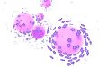 在抗 HPV 市场领域，日本诗优克能否把国产老大克优净头把交椅拉下马？