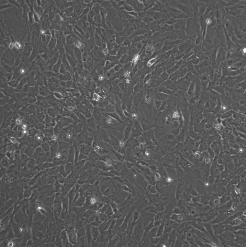 小鼠胚胎成纤维细胞分离