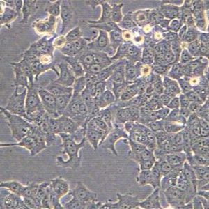 B16-F10小鼠皮肤黑色素瘤细胞实验