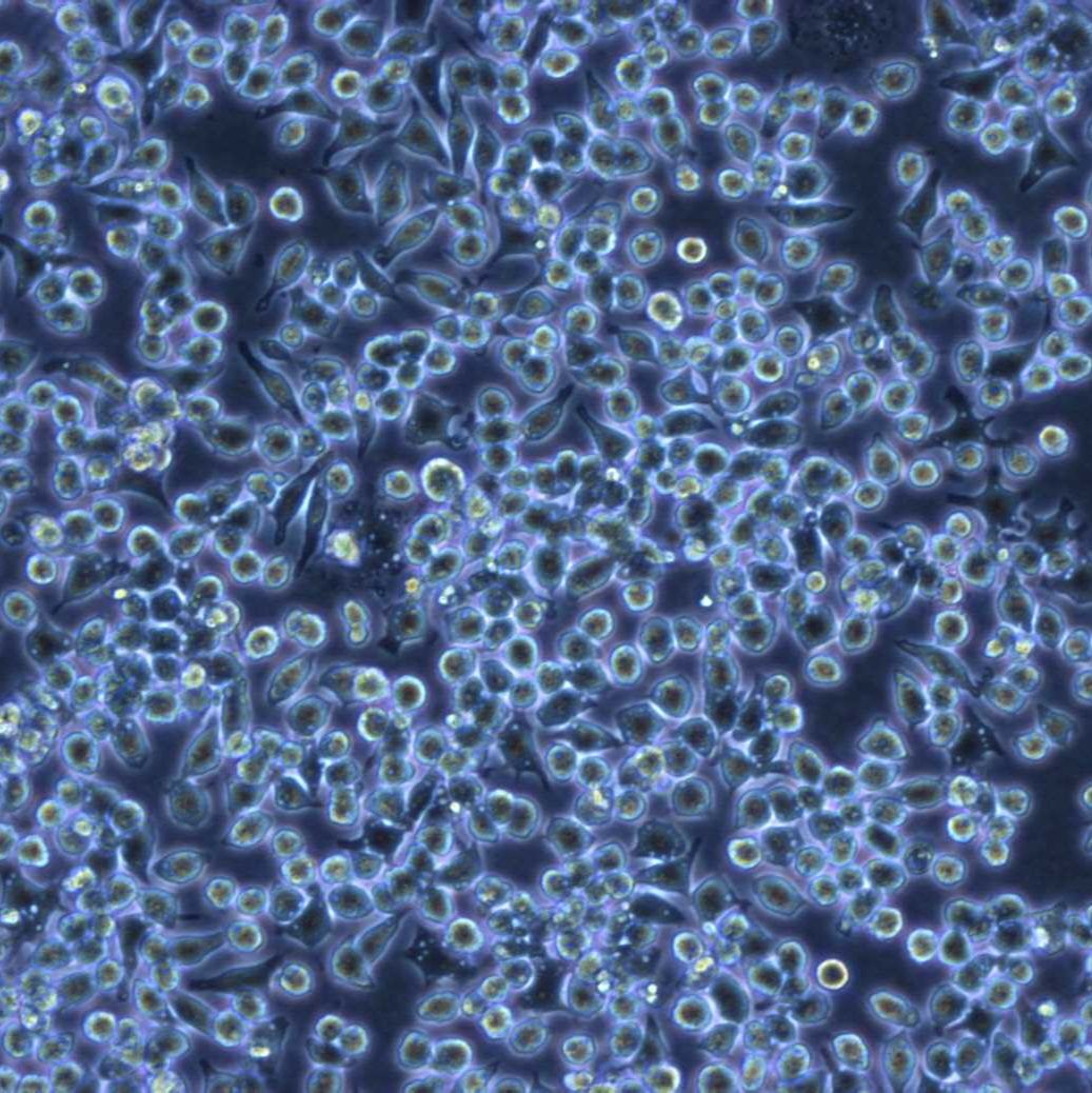 PC-12大鼠嗜铬细胞瘤细胞实验
