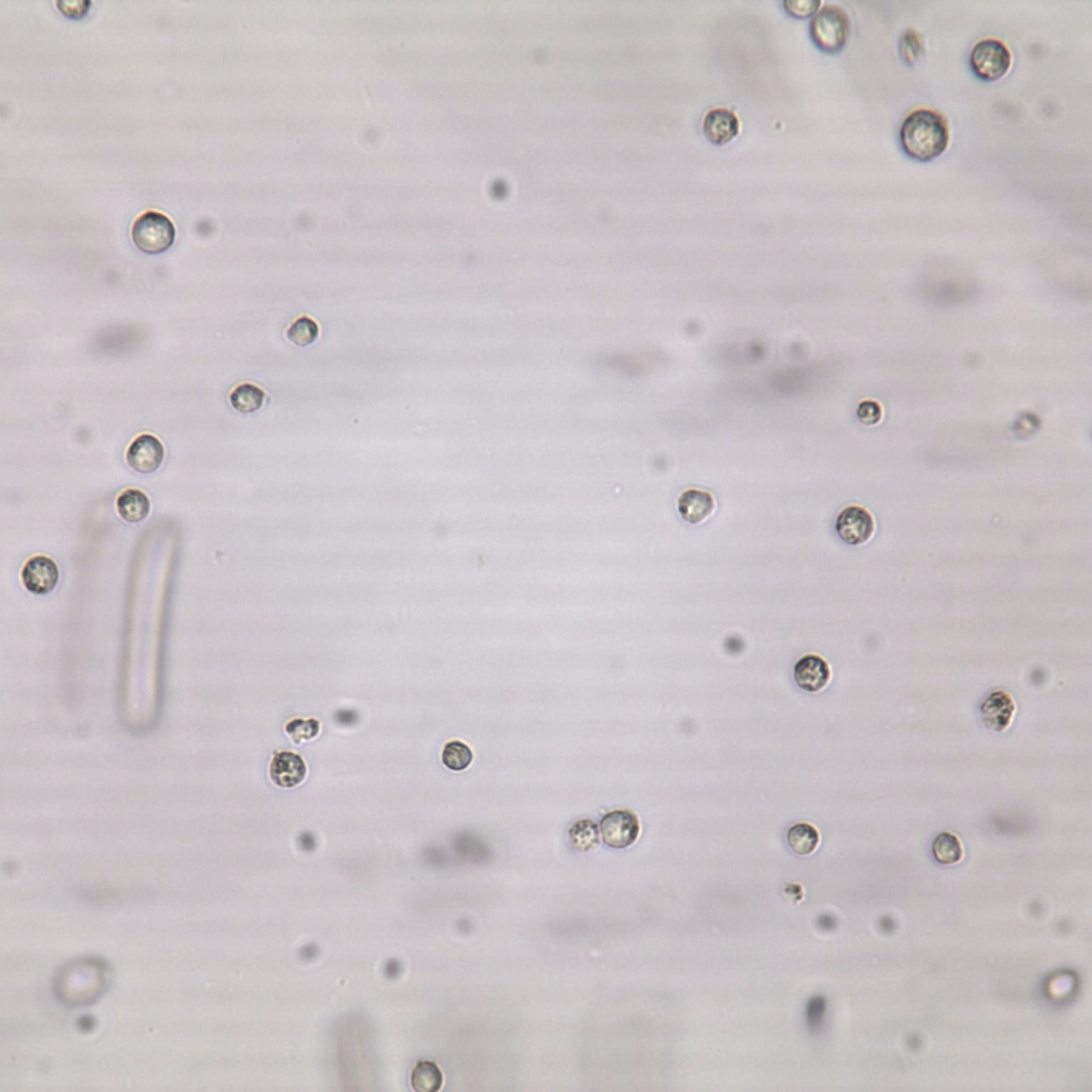 THP-1 单核细胞瘤细胞实验