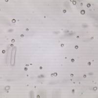 THP-1 单核细胞瘤细胞实验