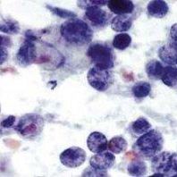 H128小细胞肺癌细胞实验