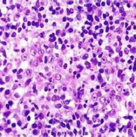 HCE-8962盲肠未分化癌细胞实验