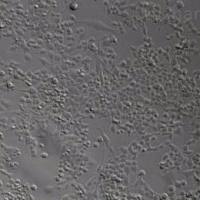 U-251脑星形胶质瘤细胞实验