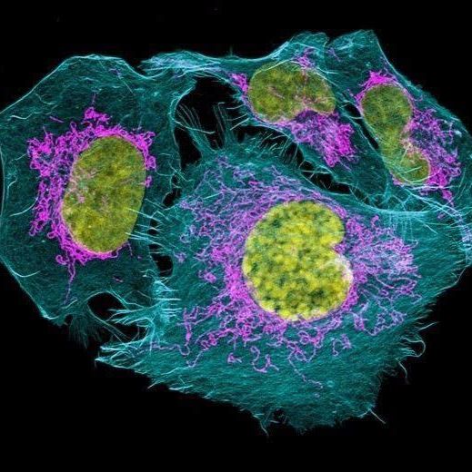 CL1前列腺癌细胞实验