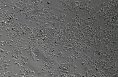 U-251脑星形胶质瘤细胞实验