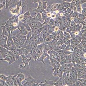HO-8910卵巢癌细胞实验