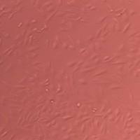 SK-N-SH脑星形胶质瘤细胞实验