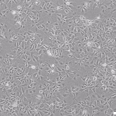 BEL-7404肝癌细胞实验