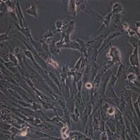 MDA-MB-435S人乳腺导管癌细胞实验