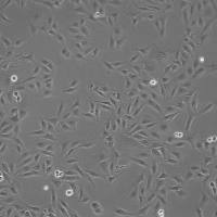 EJ膀胱癌细胞实验
