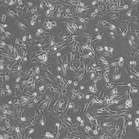 CNE2人鼻咽癌细胞实验