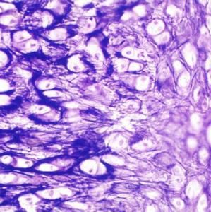 Bcap-37乳腺癌细胞实验