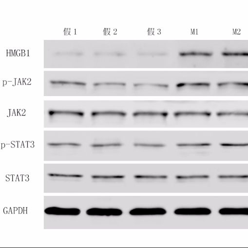 WB蛋白免疫印迹技术服务