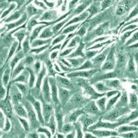 稳转株筛选实验