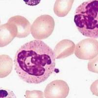 碱性磷酸酶染色(NAP)